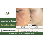 May Spa - Spa làm đẹp da Tân Bình chuyên sâu và hiệu quả