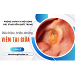 Tổng hợp các dấu hiệu, triệu chứng liên quan đến viêm tai giữa