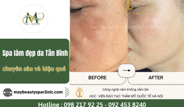 May Spa - Spa làm đẹp da Tân Bình chuyên sâu và hiệu quả