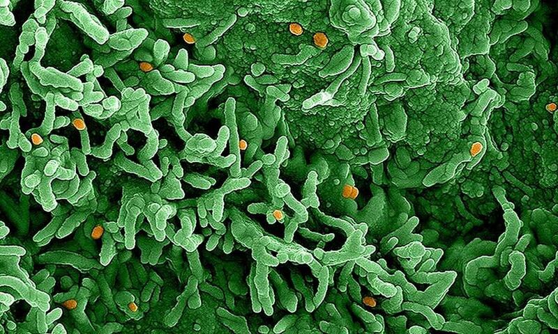 virus đậu mùa khỉ