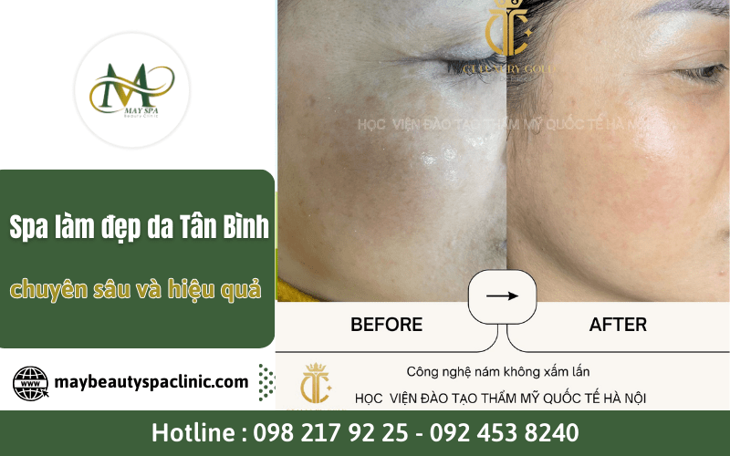 spa làm đẹp da Tân Bình