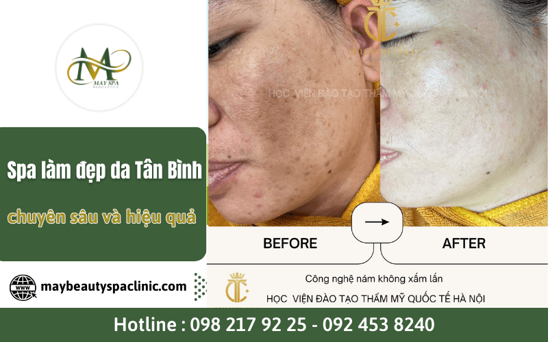 spa làm đẹp da Tân Bình