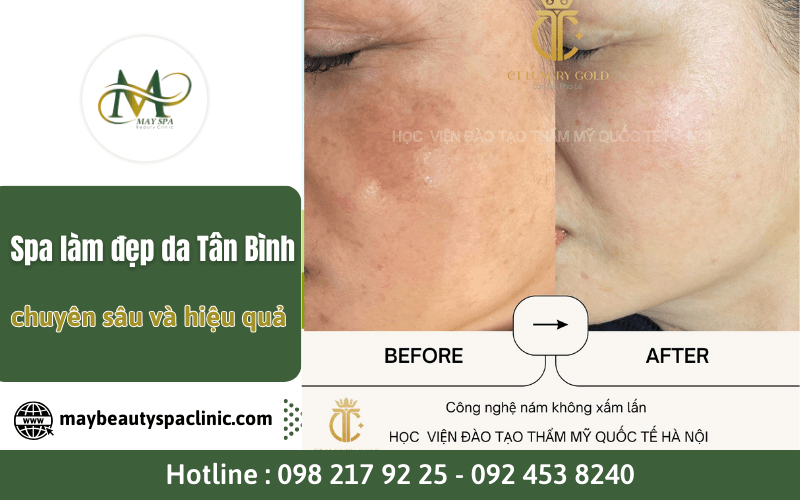 spa làm đẹp da Tân Bình