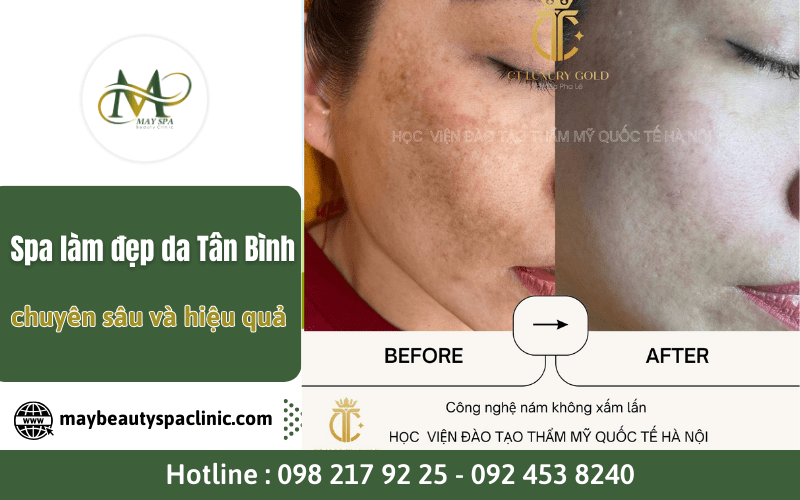 spa làm đẹp da Tân Bình