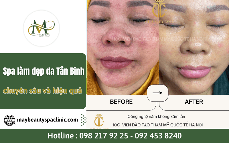 spa làm đẹp da Tân Bình